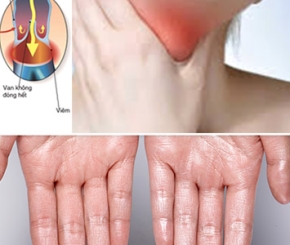 Chuyên Khoa Lồng Ngực - Mạch máu - Bướu cổ