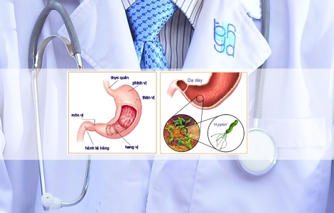 Chuyên khoa Tiêu hóa