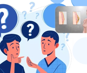 Phì đại tuyến vú ở Nam giới (Gynecomastia)