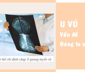 U vú - Vấn đề đáng lo ngại