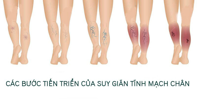 suygiantinhmach.jpg
