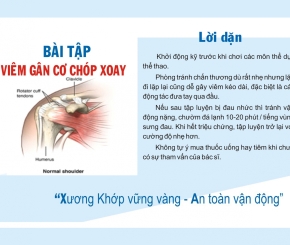Các bài tập Viêm gân cơ chớp xoay